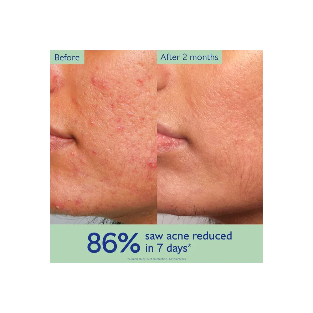 Caudalie Vinopure Acne-Prone Skin Essentials