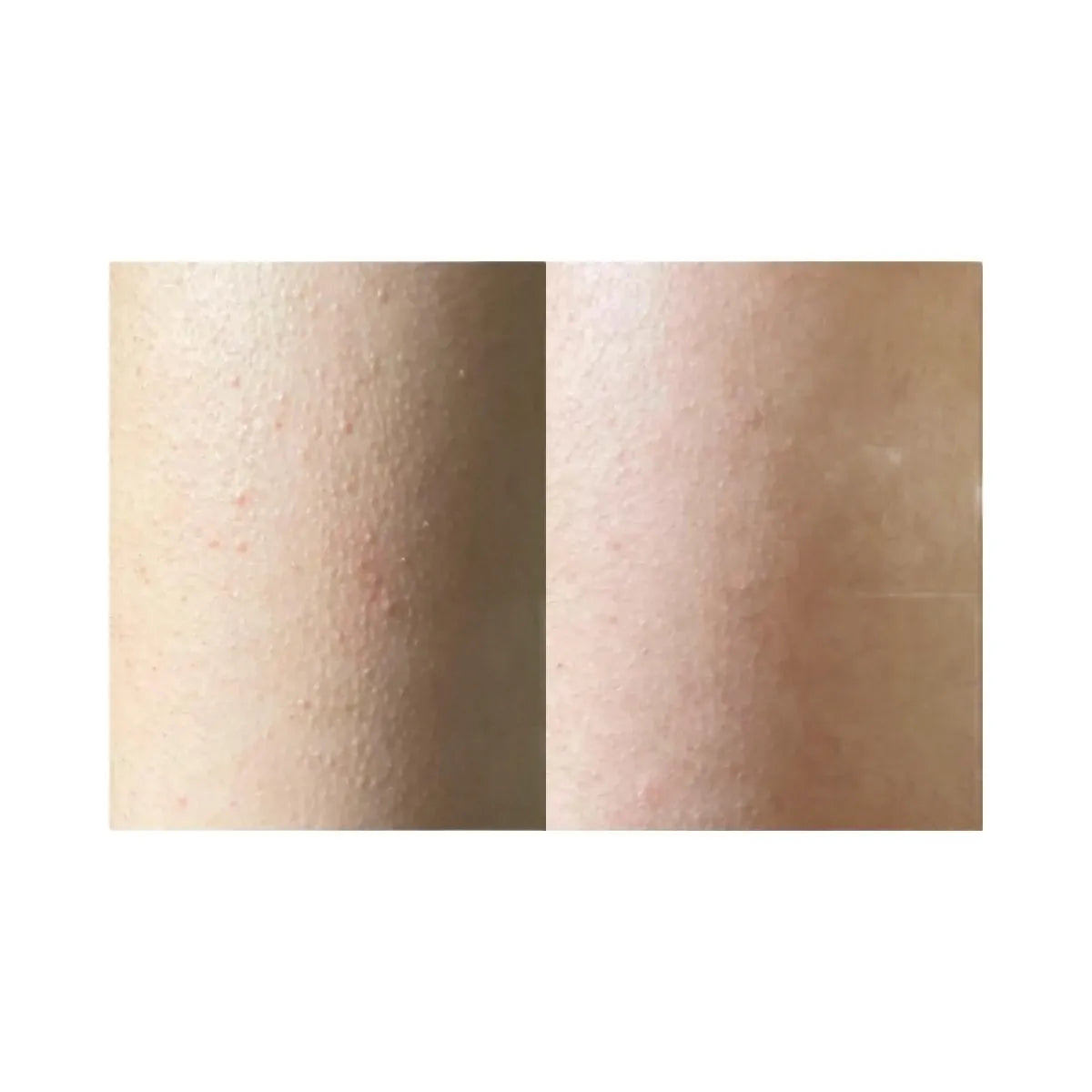 INKEY Glycolic Acid Exfoliating Body Stick