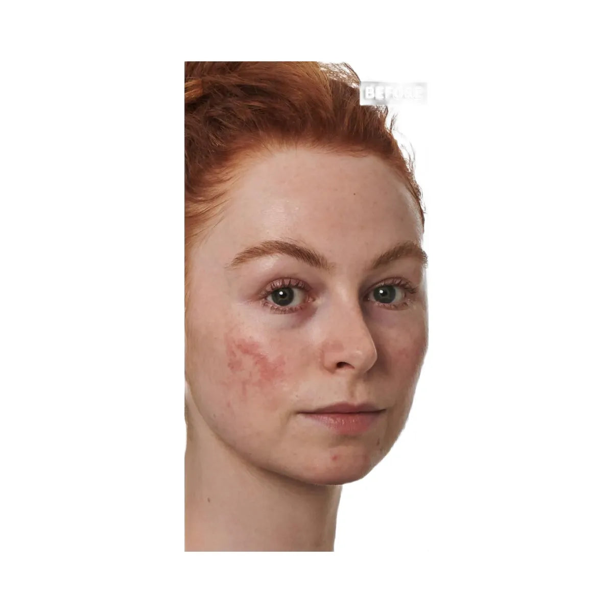 INKEY SuperSolutions 10% Azelaic Acid Serum Redness Relief Solution