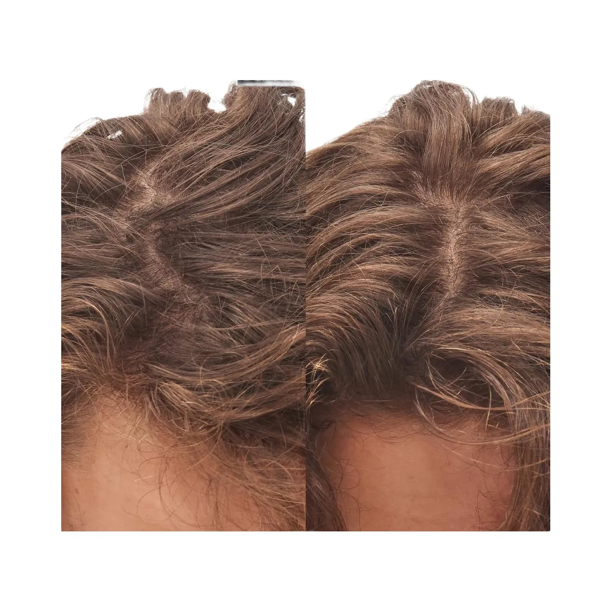 INKEY Glycolic Acid Exfoliating Scalp Scrub