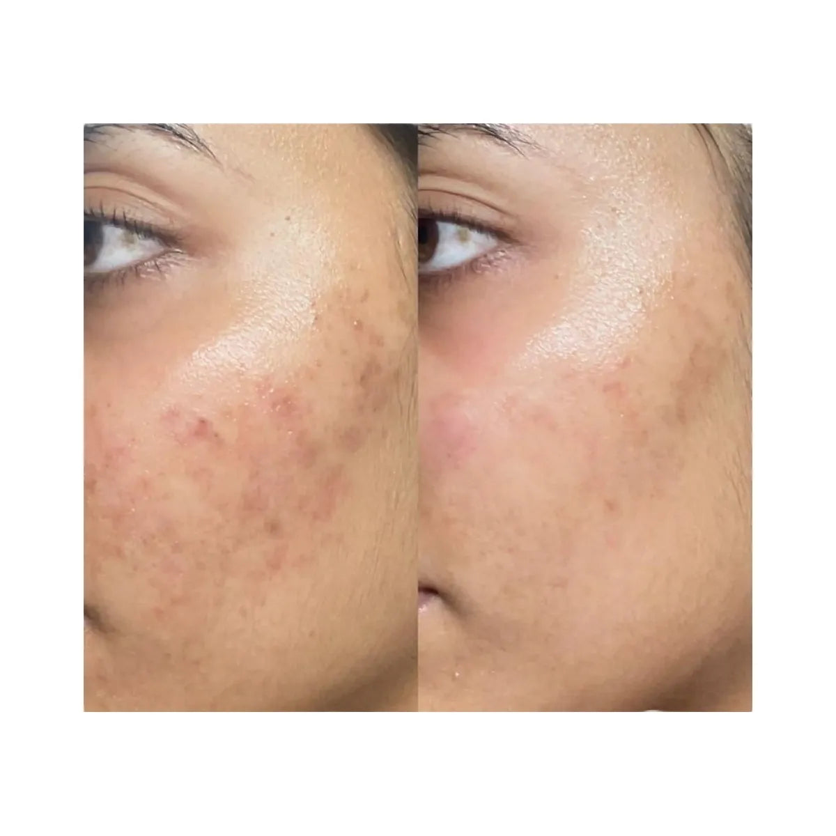 INKEY Ectoin Hydro-Barrier Serum