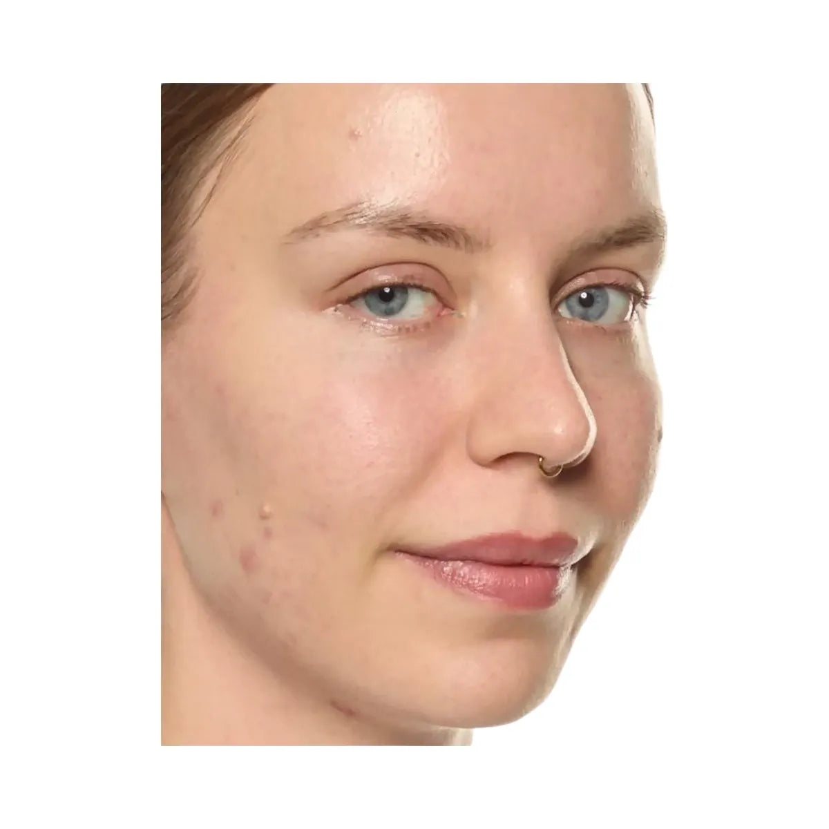 INKEY Ectoin Hydro-Barrier Serum