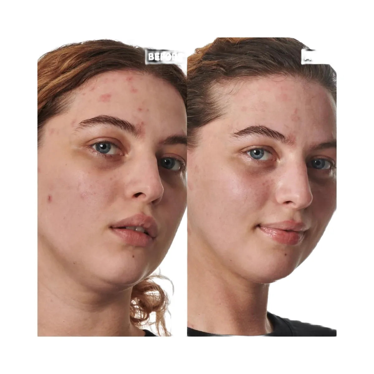 INKEY SuperSolutions 10% Urea Moisturizer Textured Skin Solution