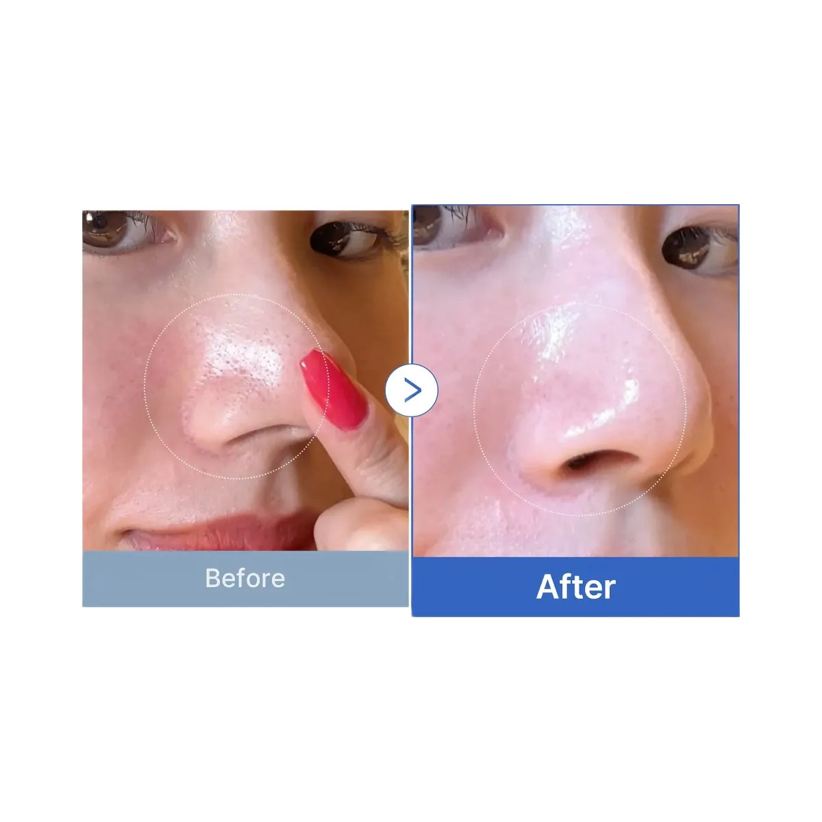 Medicube Zero Pore Pads