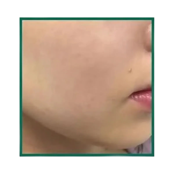 SOME BY MI AHA BHA PHA 30 Day Miracle Exfoliating Toner